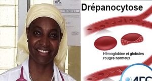 DRÉPANOCYTOSE : 1800 ENFANTS NAISSENT CHAQUE ANNÉE AVEC LA FORME SS (PÉDIATRE)