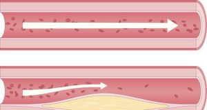 Le cholestérol en 10 questions