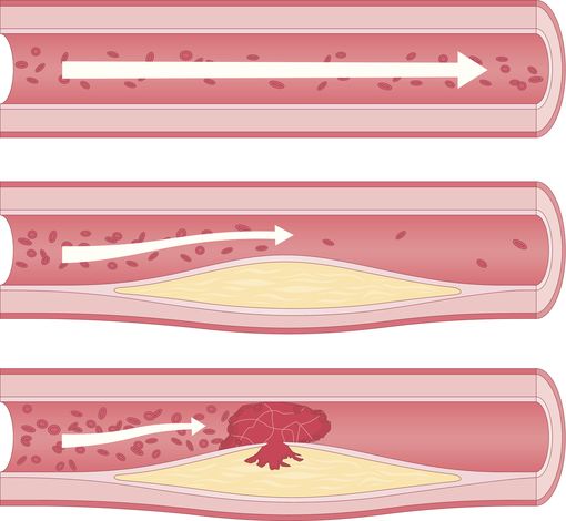 le-cholesterol-en-10-questions