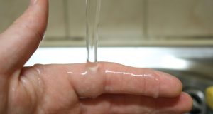 « Quels premiers soins faut-il donner lors d’une brûlure ? »