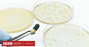 Résistance aux antibiotiques : elle pourrait causer des millions de décès chaque année selon l’OMS