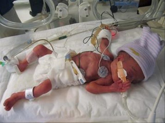 senegal-5-000-enfants-prematures-perdent-la-vie-chaque-annee-pediatre